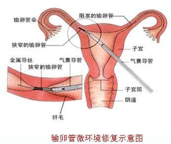 通草的功效與作用能通輸卵管堵塞,高速響應(yīng)計(jì)劃實(shí)施_高級(jí)款41.765